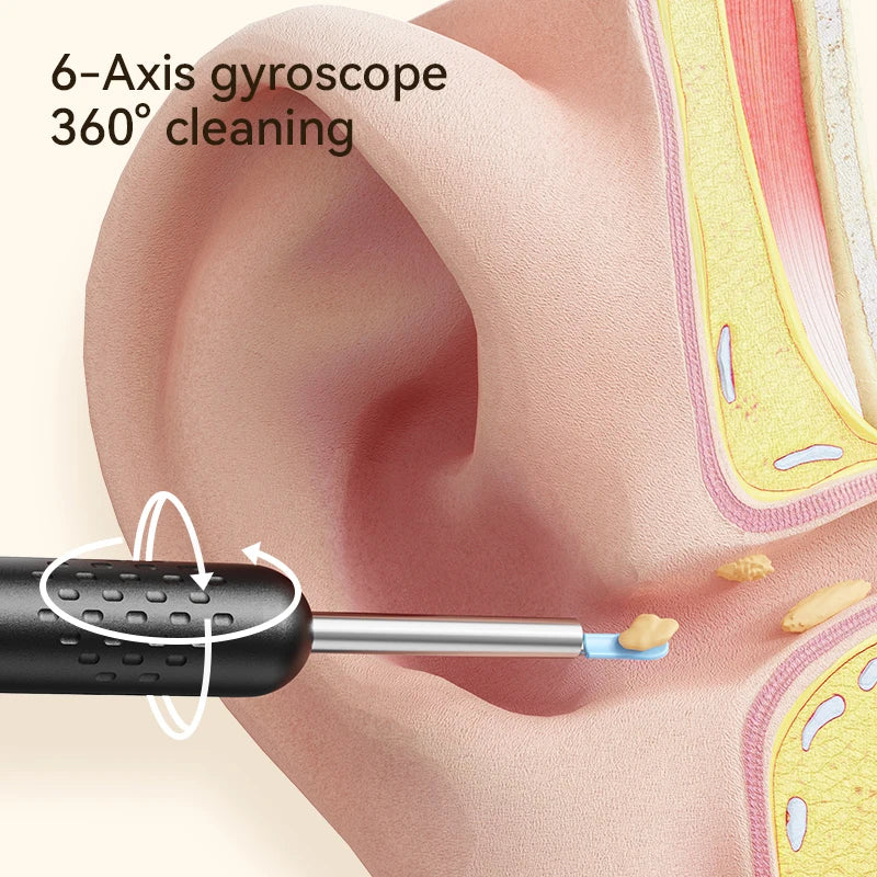HD Ear Cleaner with Camera & LED Lights