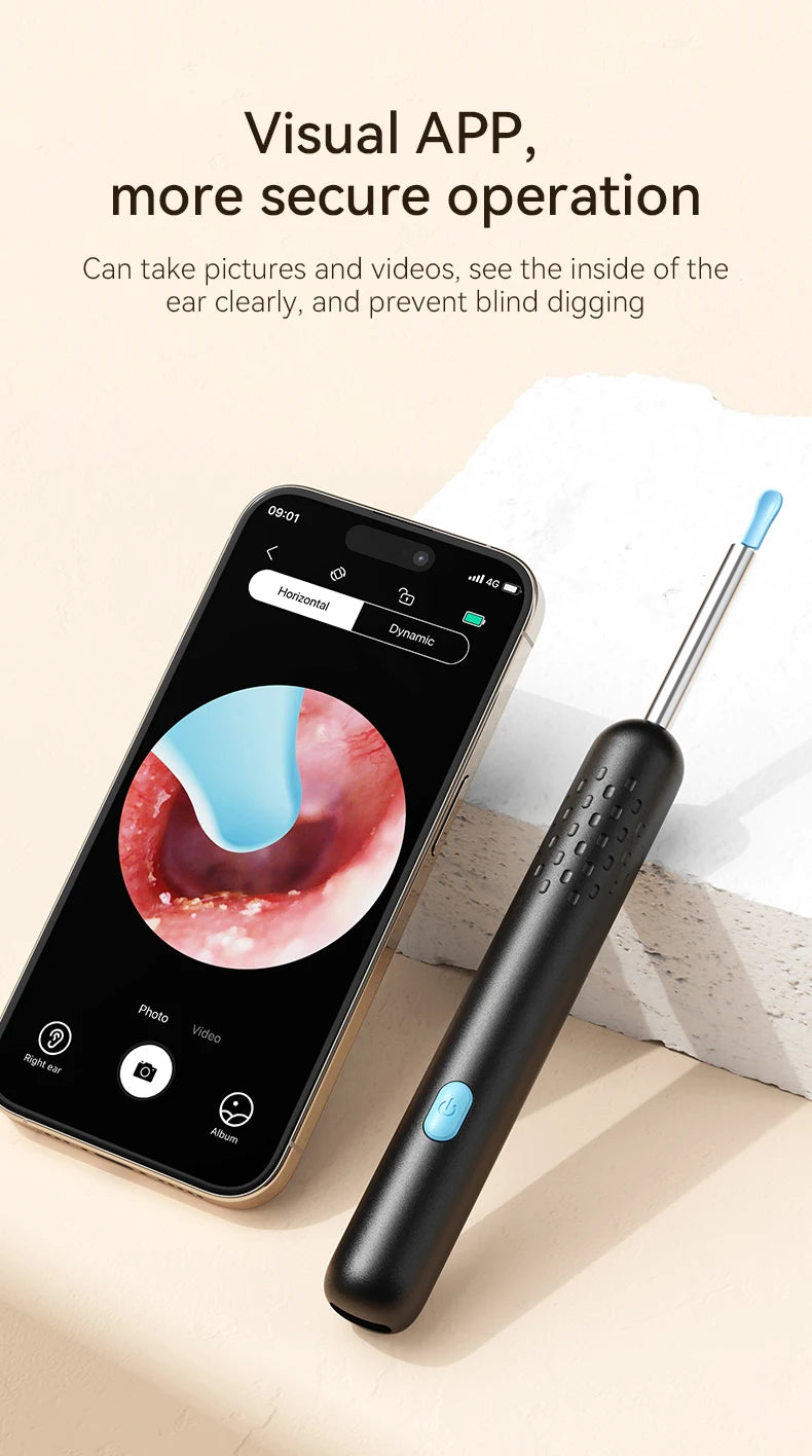 HD Ear Cleaner with Camera & LED Lights