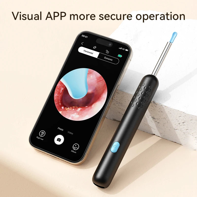 HD Ear Cleaner with Camera & LED Lights